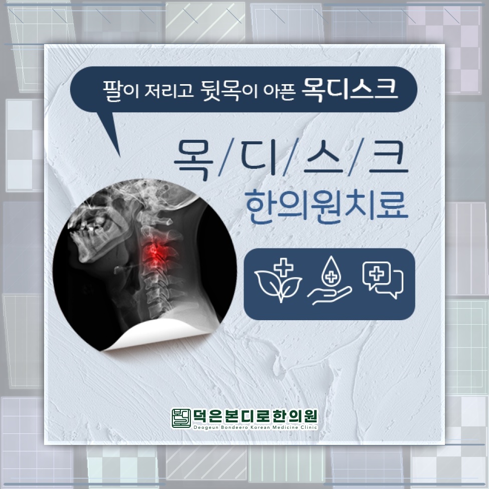 목디스크 초기 증상부터 비수술적 관리 방법 알아보기