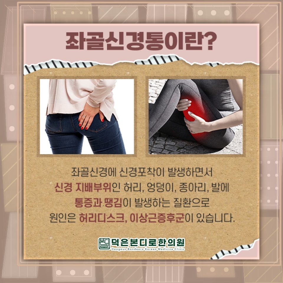 엉덩이부터 다리까지 이어지는 통증, 좌골신경통과 이상근증후군 구분하기