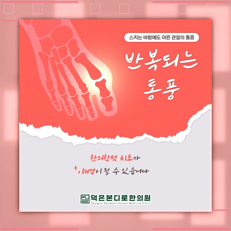 요산 결정으로 나타나는 통풍, 일상에서의 대처법