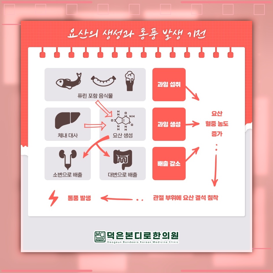 요산 결정으로 나타나는 통풍, 일상에서의 대처법