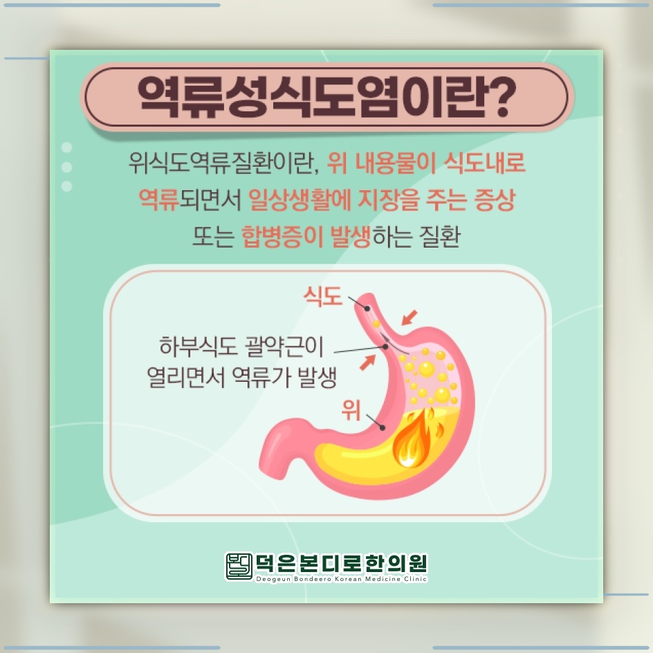 가슴이 타는 듯한 속쓰림, 역류성식도염에서 나타나는 이유