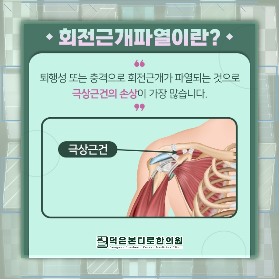 어깨 통증과 움직임 제한을 부르는 회전근개파열